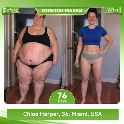 𝐀𝐤𝐲𝐠𝐨® 𝟐𝟎𝟐𝟔 𝐌𝐨𝐫𝐢𝐧𝐠𝐚 x 𝐁𝐞𝐫𝐛𝐞𝐫𝐢𝐧𝐞 x 𝐍𝐀𝐃+ 𝟔-𝐈𝐧-𝟏 𝐌𝐢𝐜𝐫𝐨-𝐏𝐚𝐫𝐭𝐢𝐜𝐥𝐞 𝐒𝐜𝐮𝐥𝐩𝐭𝐢𝐧𝐠 & 𝐅𝐚𝐭-𝐁𝐮𝐫𝐧 𝐒𝐡𝐨𝐫𝐭𝐬