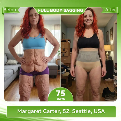 𝐀𝐤𝐲𝐠𝐨® 𝟐𝟎𝟐𝟔 𝐌𝐨𝐫𝐢𝐧𝐠𝐚 x 𝐁𝐞𝐫𝐛𝐞𝐫𝐢𝐧𝐞 x 𝐍𝐀𝐃+ 𝟔-𝐈𝐧-𝟏 𝐌𝐢𝐜𝐫𝐨-𝐏𝐚𝐫𝐭𝐢𝐜𝐥𝐞 𝐒𝐜𝐮𝐥𝐩𝐭𝐢𝐧𝐠 & 𝐅𝐚𝐭-𝐁𝐮𝐫𝐧 𝐒𝐡𝐨𝐫𝐭𝐬